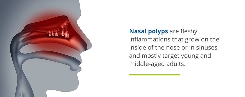 what are nasal polyps