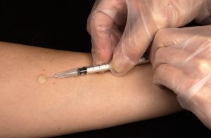 What is Immunology or Allergy Shot?